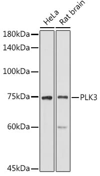 Western blot analysis of extracts of various cell lines, using Anti-PLK3 Antibody (A8674) at 1:1,000 dilution.
Secondary antibody: Goat Anti-Rabbit IgG (H+L) (HRP) (AS014) at 1:10,000 dilution.
Lysates / proteins: 25µg per lane.
Blocking buffer: 3% non-fat dry milk in TBST.
Detection: ECL Basic Kit (RM00020).
Exposure time: 10s.