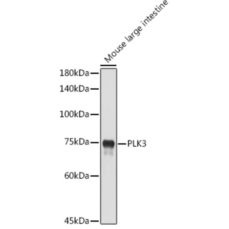 Western Blot - Anti-PLK3 Antibody (A16258) - Antibodies.com