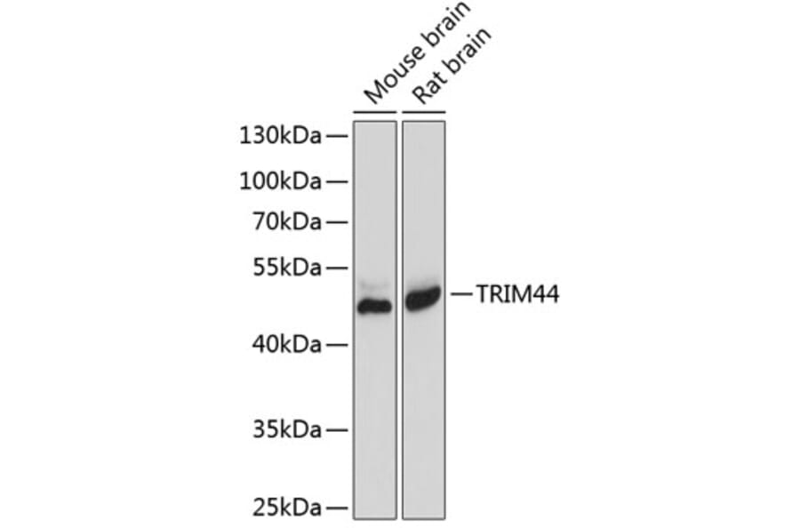 Western Blot - Anti-TRIM44 Antibody (A8719) - Antibodies.com