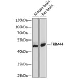 Western Blot - Anti-TRIM44 Antibody (A8719) - Antibodies.com