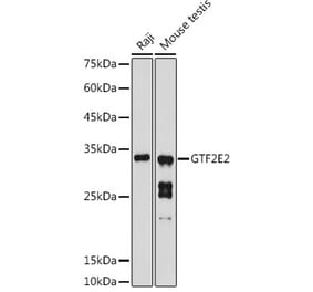 Western Blot - Anti-GTF2E2 Antibody (A16260) - Antibodies.com