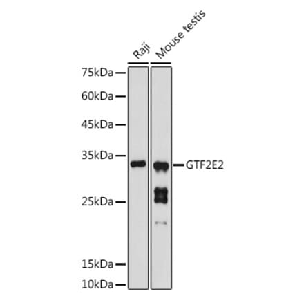 Western Blot - Anti-GTF2E2 Antibody (A16260) - Antibodies.com