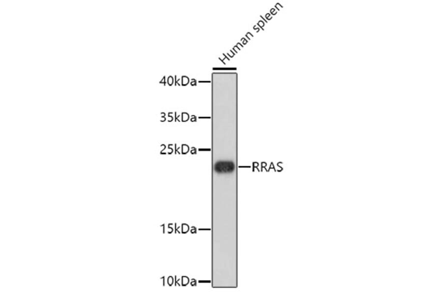 Western Blot - Anti-RRAS Antibody (A8741) - Antibodies.com