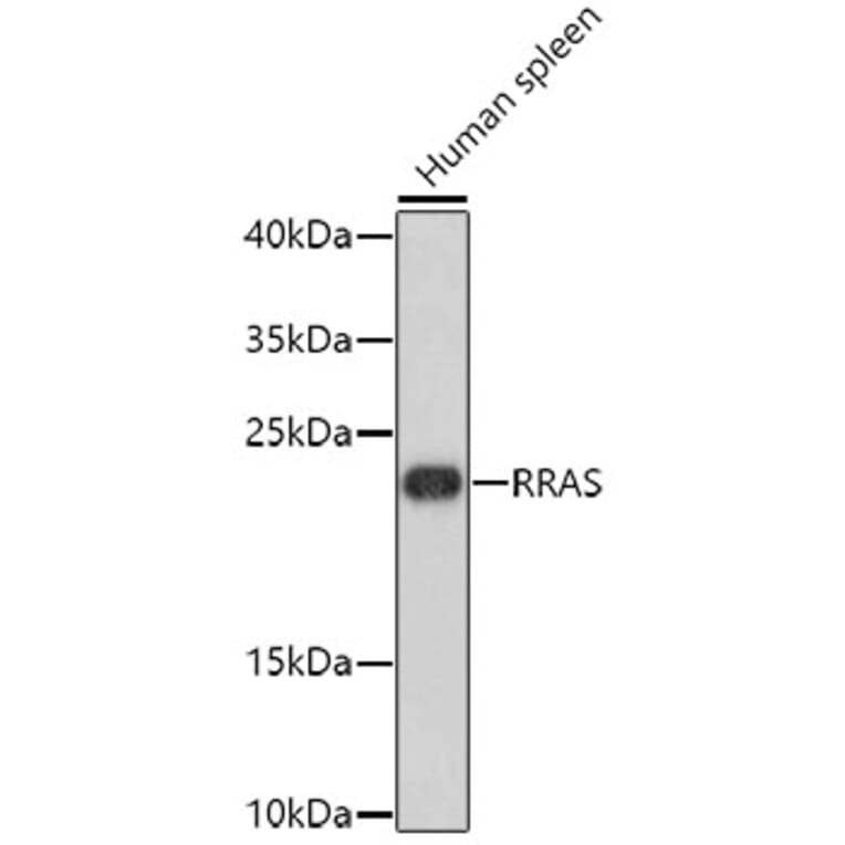 Western Blot - Anti-RRAS Antibody (A8741) - Antibodies.com