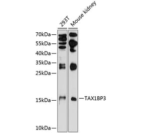 Western Blot - Anti-TIP-1 Antibody (A16262) - Antibodies.com
