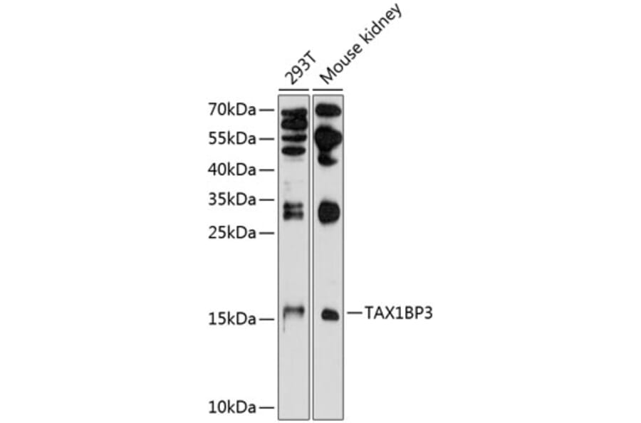 Western Blot - Anti-TIP-1 Antibody (A16262) - Antibodies.com