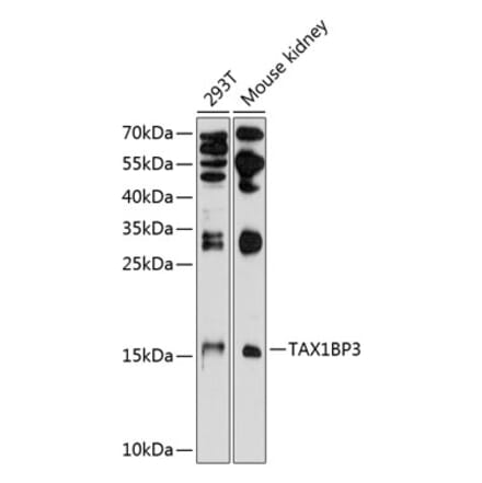 Western Blot - Anti-TIP-1 Antibody (A16262) - Antibodies.com