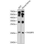 Western Blot - Anti-TIP-1 Antibody (A16262) - Antibodies.com