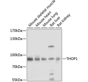 Western Blot - Anti-Thimet Oligopeptidase Antibody (A16263) - Antibodies.com