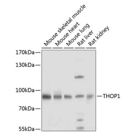 Western Blot - Anti-Thimet Oligopeptidase Antibody (A16263) - Antibodies.com