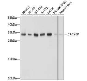 Western Blot - Anti-CacyBP Antibody (A16264) - Antibodies.com