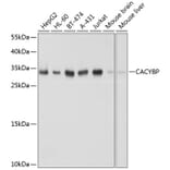 Western Blot - Anti-CacyBP Antibody (A16264) - Antibodies.com