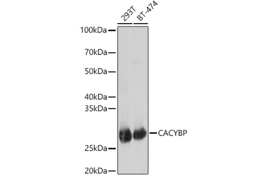 Western Blot - Anti-CacyBP Antibody (A16264) - Antibodies.com