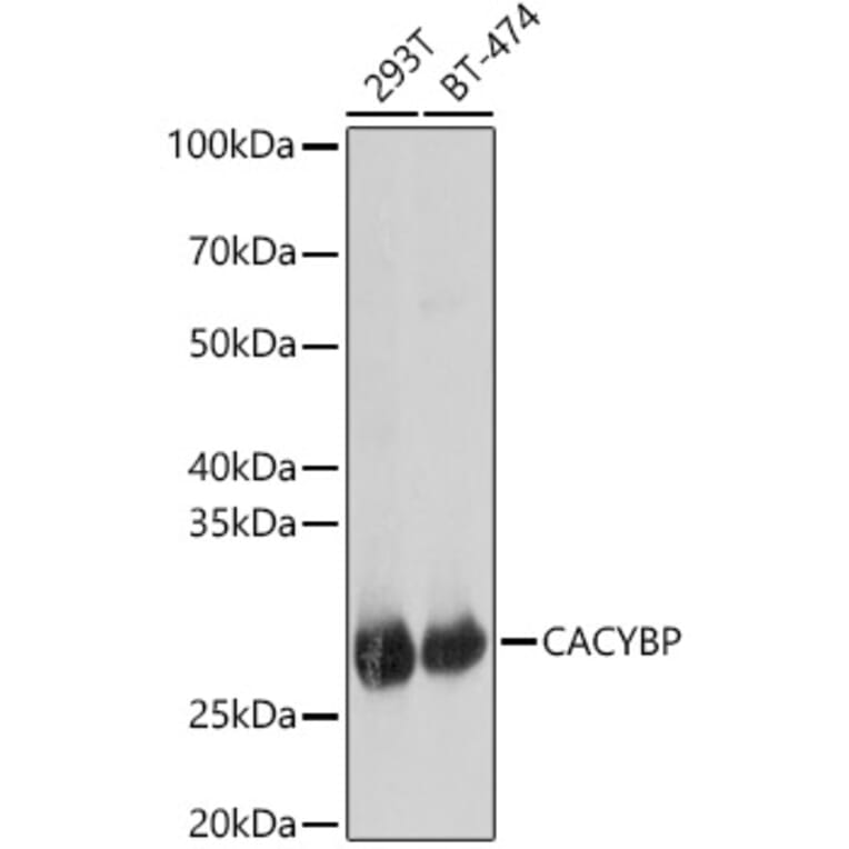 Western Blot - Anti-CacyBP Antibody (A16264) - Antibodies.com