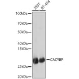 Western Blot - Anti-CacyBP Antibody (A16264) - Antibodies.com