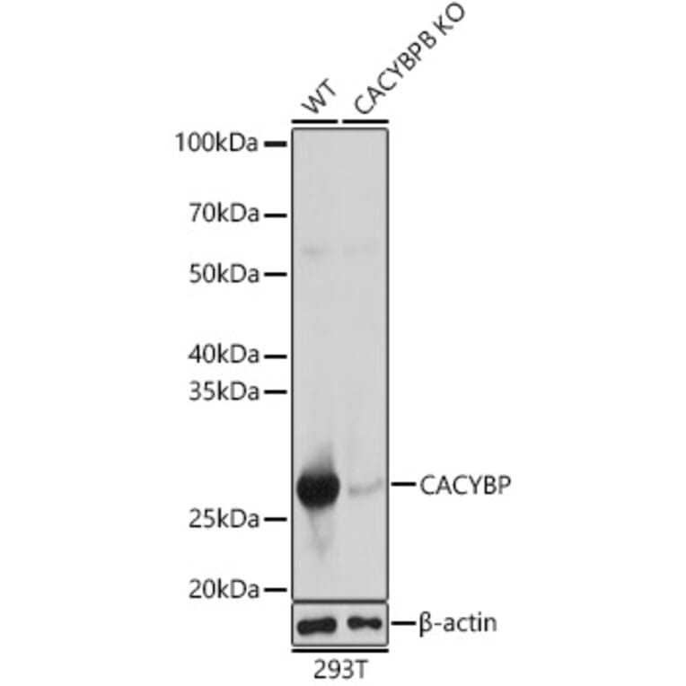 Western Blot - Anti-CacyBP Antibody (A16264) - Antibodies.com