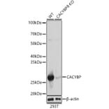 Western Blot - Anti-CacyBP Antibody (A16264) - Antibodies.com