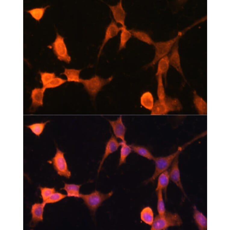 Immunofluorescence - Anti-CacyBP Antibody (A16264) - Antibodies.com