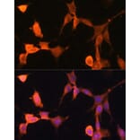 Immunofluorescence - Anti-CacyBP Antibody (A16264) - Antibodies.com