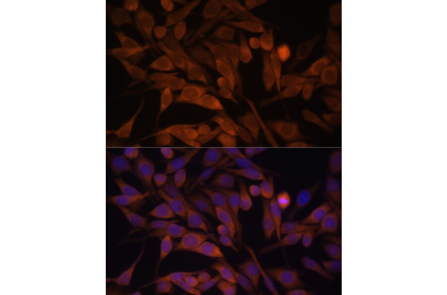 Immunofluorescence - Anti-CacyBP Antibody (A16264) - Antibodies.com