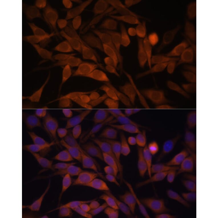 Immunofluorescence - Anti-CacyBP Antibody (A16264) - Antibodies.com