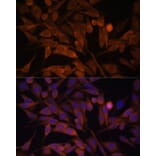 Immunofluorescence - Anti-CacyBP Antibody (A16264) - Antibodies.com