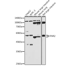 Western Blot - Anti-PAR2 Antibody (A16266) - Antibodies.com