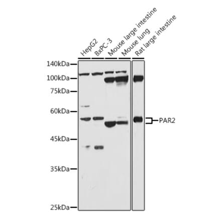 Western Blot - Anti-PAR2 Antibody (A16266) - Antibodies.com