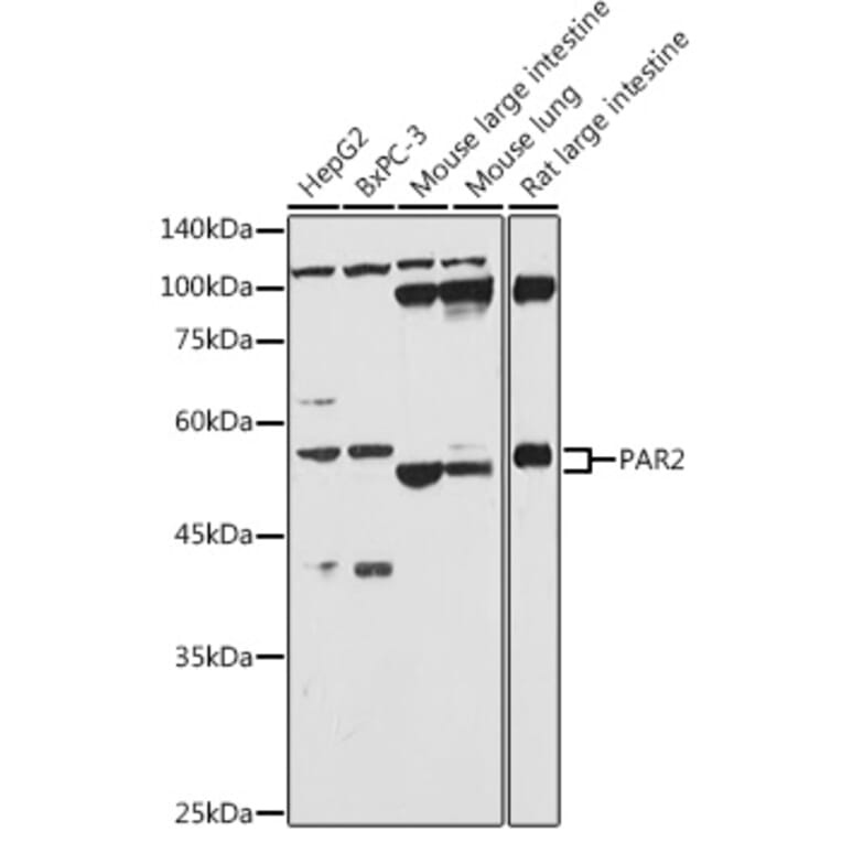 Western Blot - Anti-PAR2 Antibody (A16266) - Antibodies.com