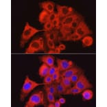 Immunofluorescence - Anti-PAR2 Antibody (A16266) - Antibodies.com