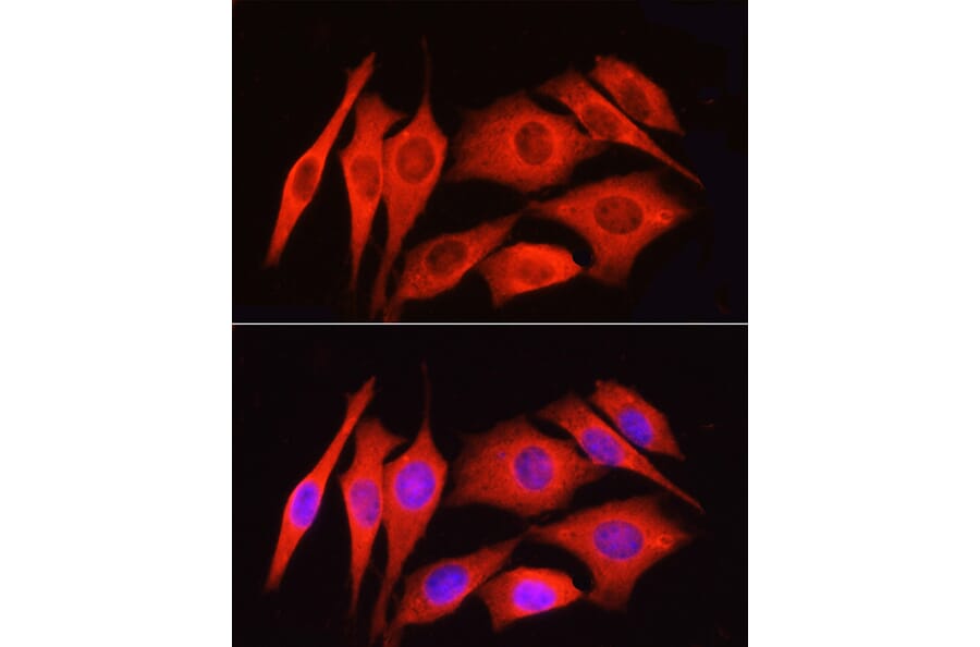 Immunofluorescence - Anti-PAR2 Antibody (A16266) - Antibodies.com
