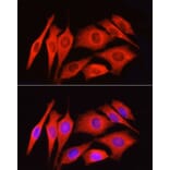 Immunofluorescence - Anti-PAR2 Antibody (A16266) - Antibodies.com