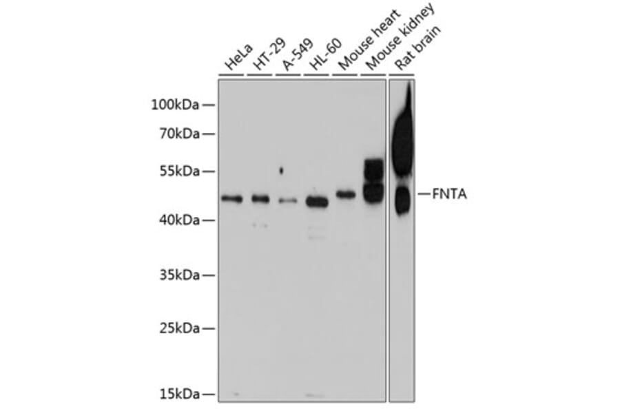 Western Blot - Anti-FNTA Antibody (A16267) - Antibodies.com