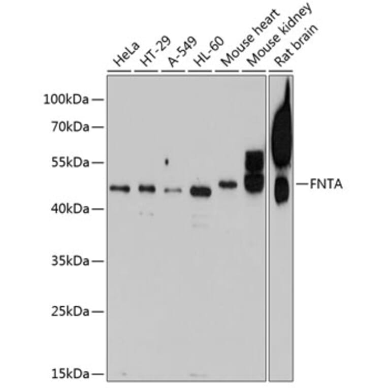 Western Blot - Anti-FNTA Antibody (A16267) - Antibodies.com