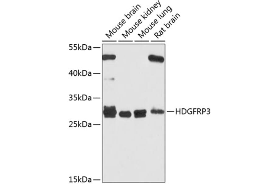 Western Blot - Anti-HDGFL3 Antibody (A16268) - Antibodies.com
