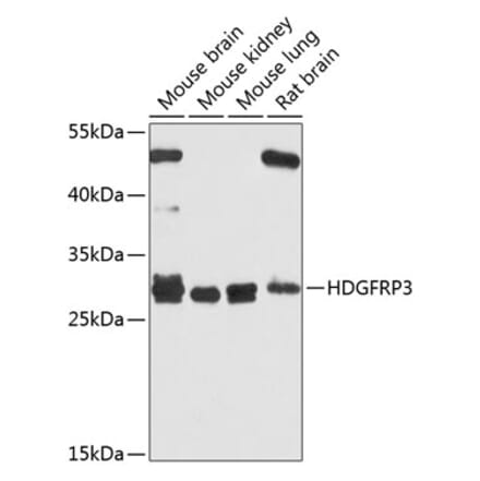 Western Blot - Anti-HDGFL3 Antibody (A16268) - Antibodies.com