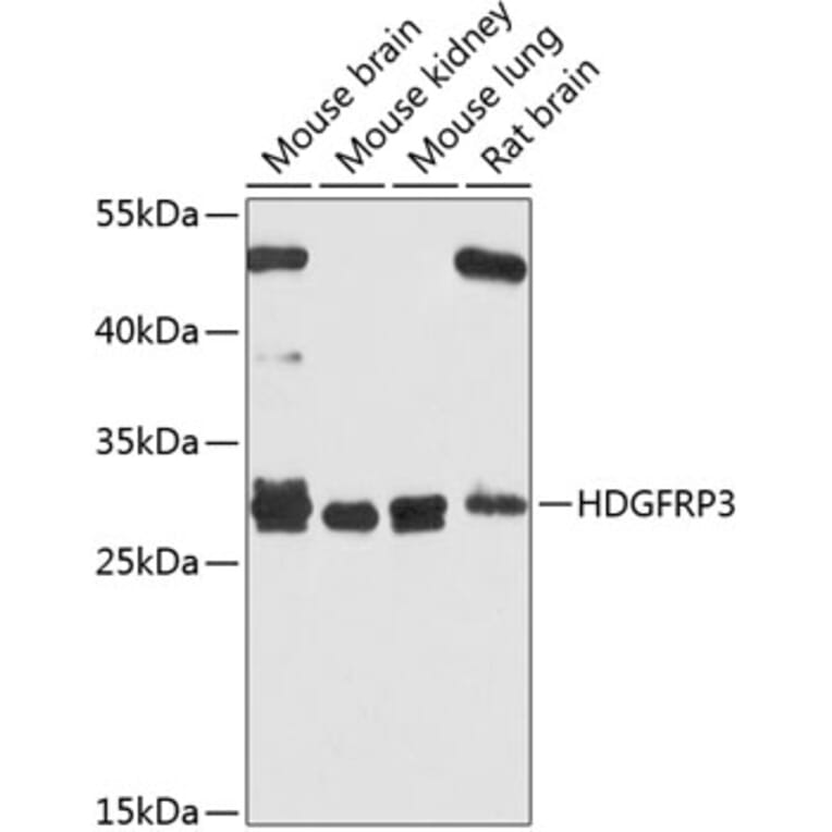 Western Blot - Anti-HDGFL3 Antibody (A16268) - Antibodies.com