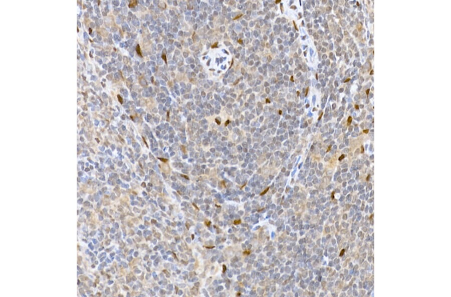 Immunohistochemistry - Anti-HDGFL3 Antibody (A16268) - Antibodies.com
