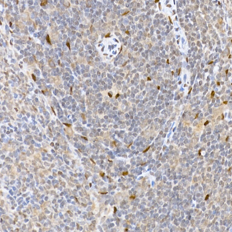 Immunohistochemistry - Anti-HDGFL3 Antibody (A16268) - Antibodies.com