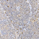 Immunohistochemistry - Anti-HDGFL3 Antibody (A16268) - Antibodies.com