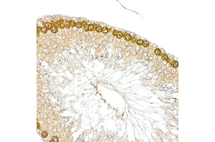 Immunohistochemistry - Anti-HDGFL3 Antibody (A16268) - Antibodies.com