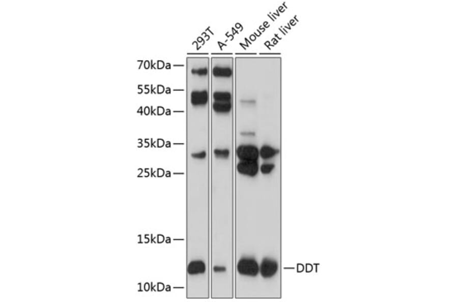 Western Blot - Anti-DDT Antibody (A16269) - Antibodies.com