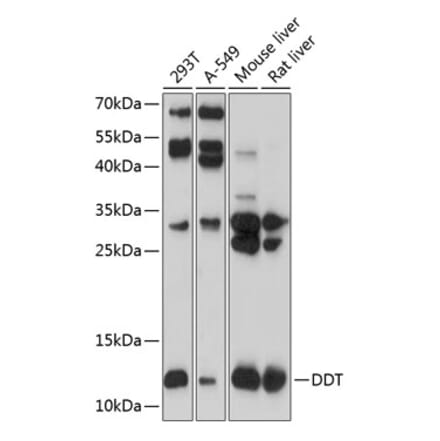 Western Blot - Anti-DDT Antibody (A16269) - Antibodies.com