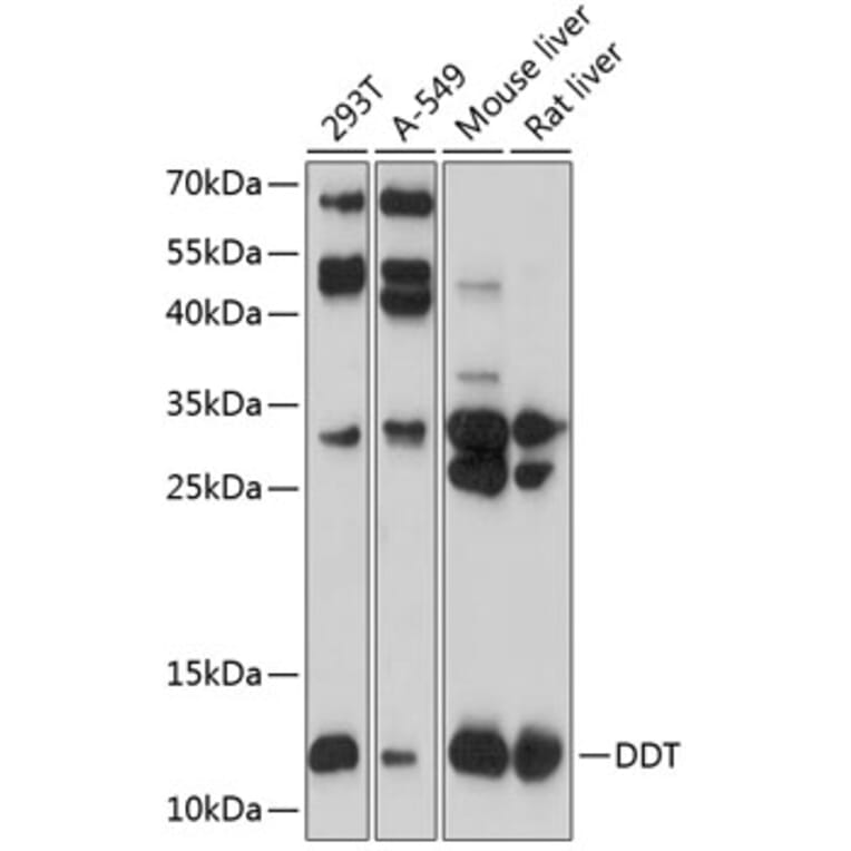 Western Blot - Anti-DDT Antibody (A16269) - Antibodies.com