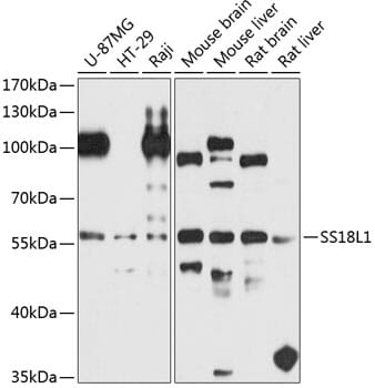 Western blot analysis of extracts of various cell lines, using Anti-SS18L1 Antibody (A8822) at 1:1,000 dilution.
Secondary antibody: Goat Anti-Rabbit IgG (H+L) (HRP) (AS014) at 1:10,000 dilution.
Lysates / proteins: 25µg per lane.
Blocking buffer: 3% non-fat dry milk in TBST.
Detection: ECL Basic Kit (RM00020).
Exposure time: 90s.