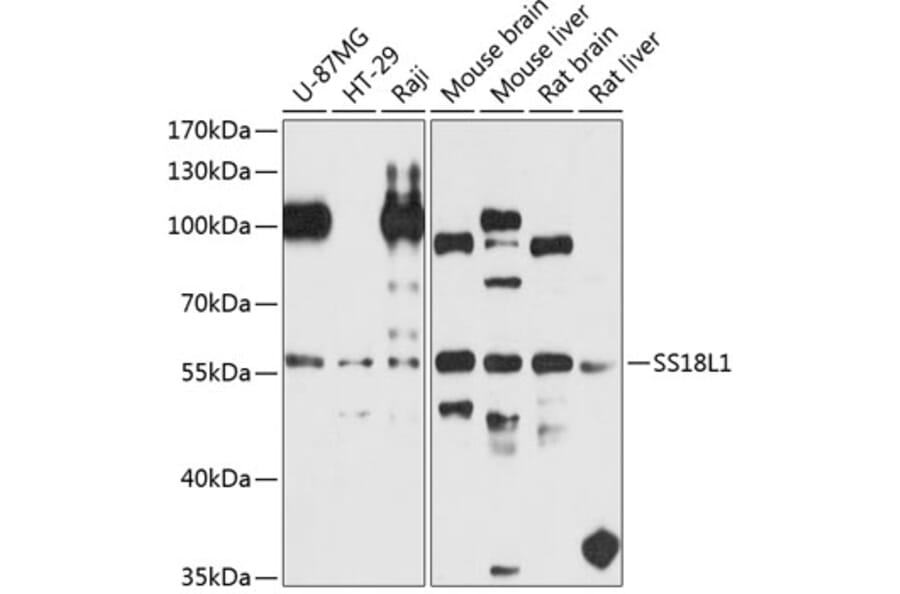 Western Blot - Anti-CREST Antibody (A16270) - Antibodies.com