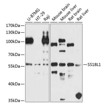 Western Blot - Anti-CREST Antibody (A16270) - Antibodies.com