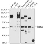 Western Blot - Anti-CREST Antibody (A16270) - Antibodies.com