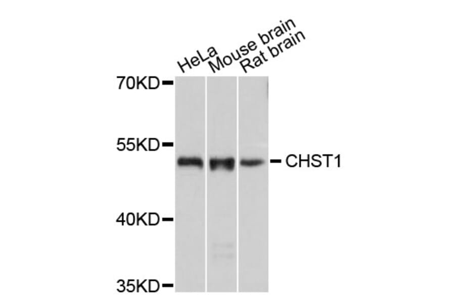 Western Blot - Anti-CHST1 Antibody (A8828) - Antibodies.com