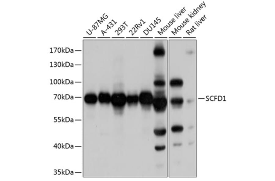 Western Blot - Anti-Sly1 Antibody (A16272) - Antibodies.com